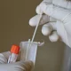 Desperdício de R$ 43 milhões: Ministério da Saúde perde 1,2 milhão de testes para Covid-19